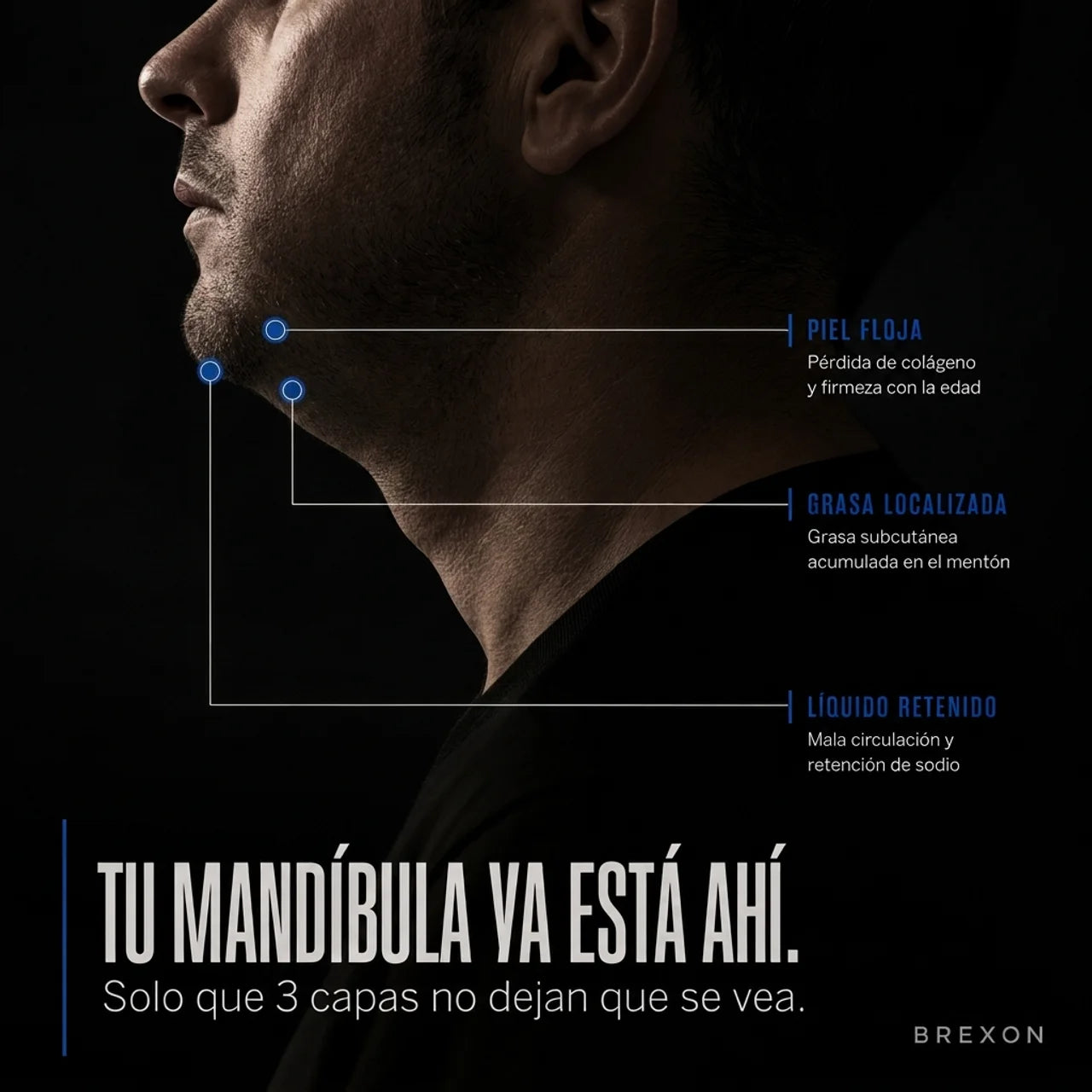 Brexon™ — Crema Definición Mandibular