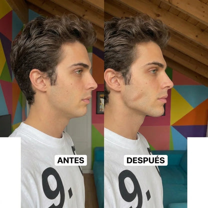 Brexon™ — Crema Definición Mandibular